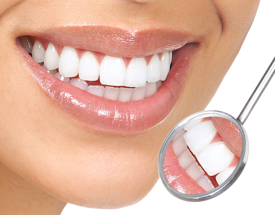 Veneers | Dentist In Cary, NC | Karen Torres, DDS, PA